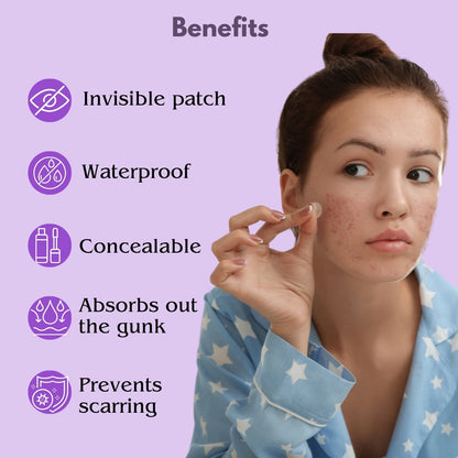 Alvida Acne - Hydrocolloid Acne Pimple Patches with Tea Tree, Neem & Salicylic Acid | 2 Sizes (72 dots)